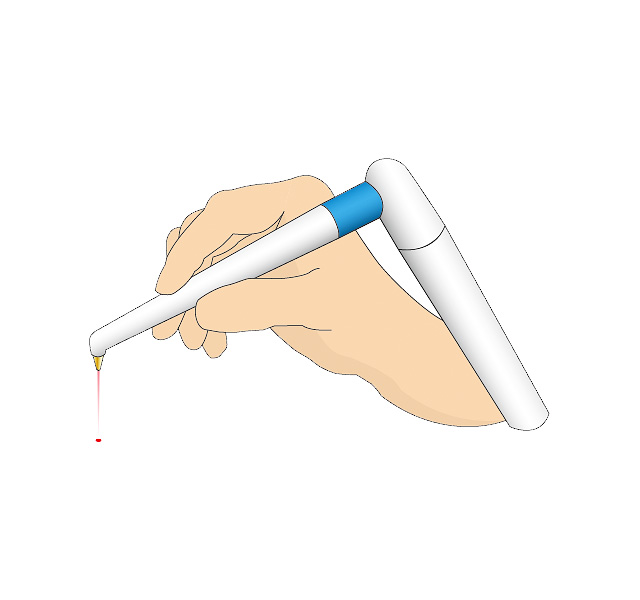 歯科レーザ治療器照射位置表示